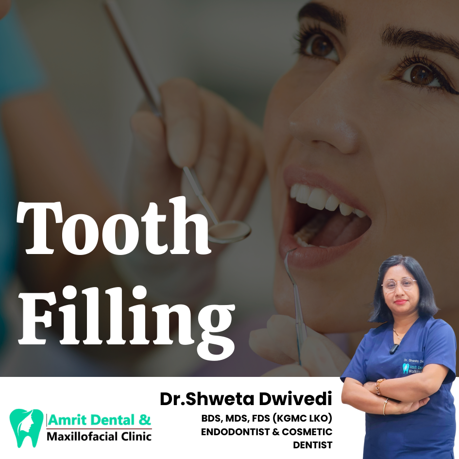 Tooth Filling