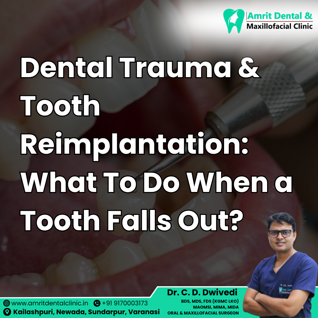 🦷 Dental Trauma & Tooth Reimplantation: What To Do When a Tooth Falls Out?