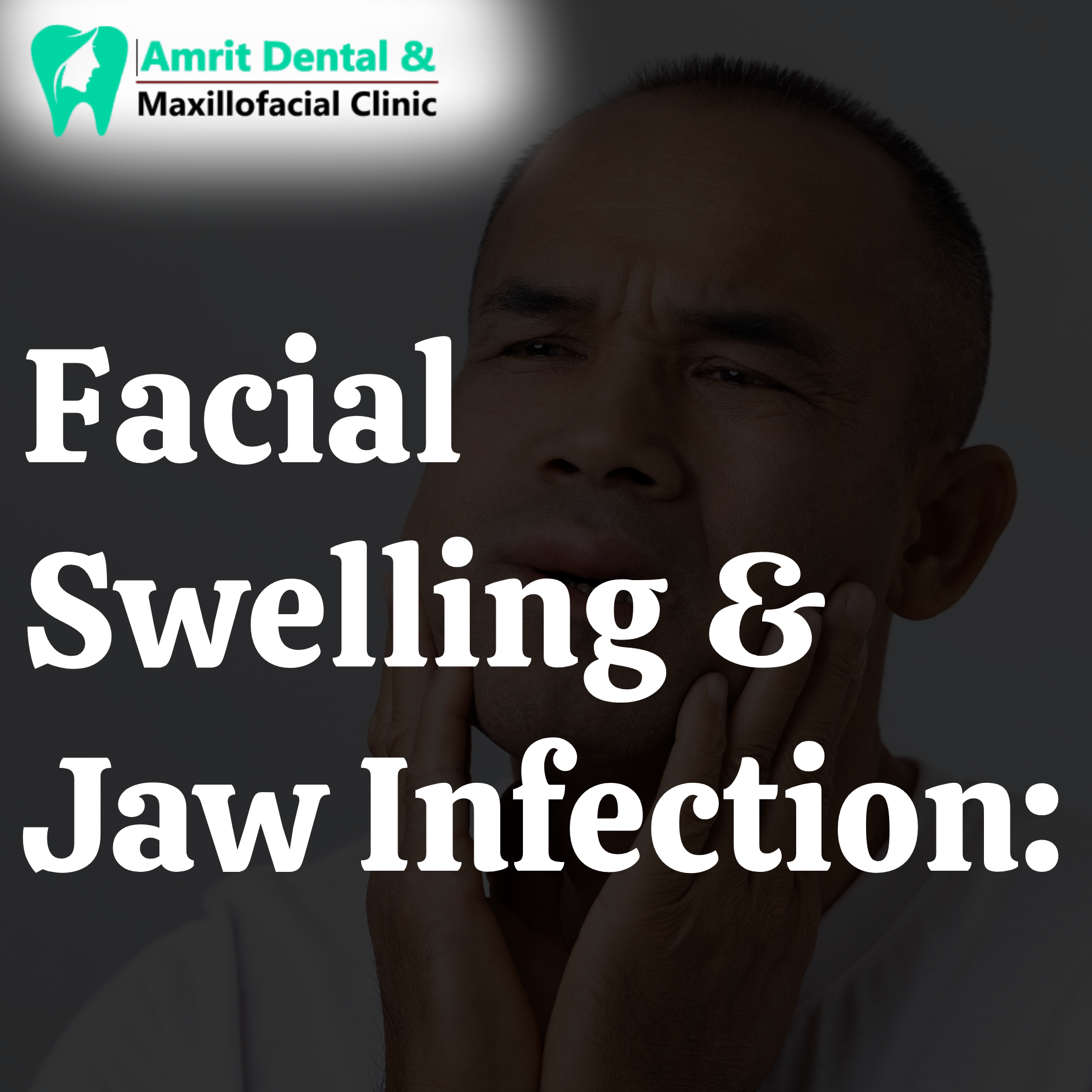 Facial Swelling & Jaw Infection:
