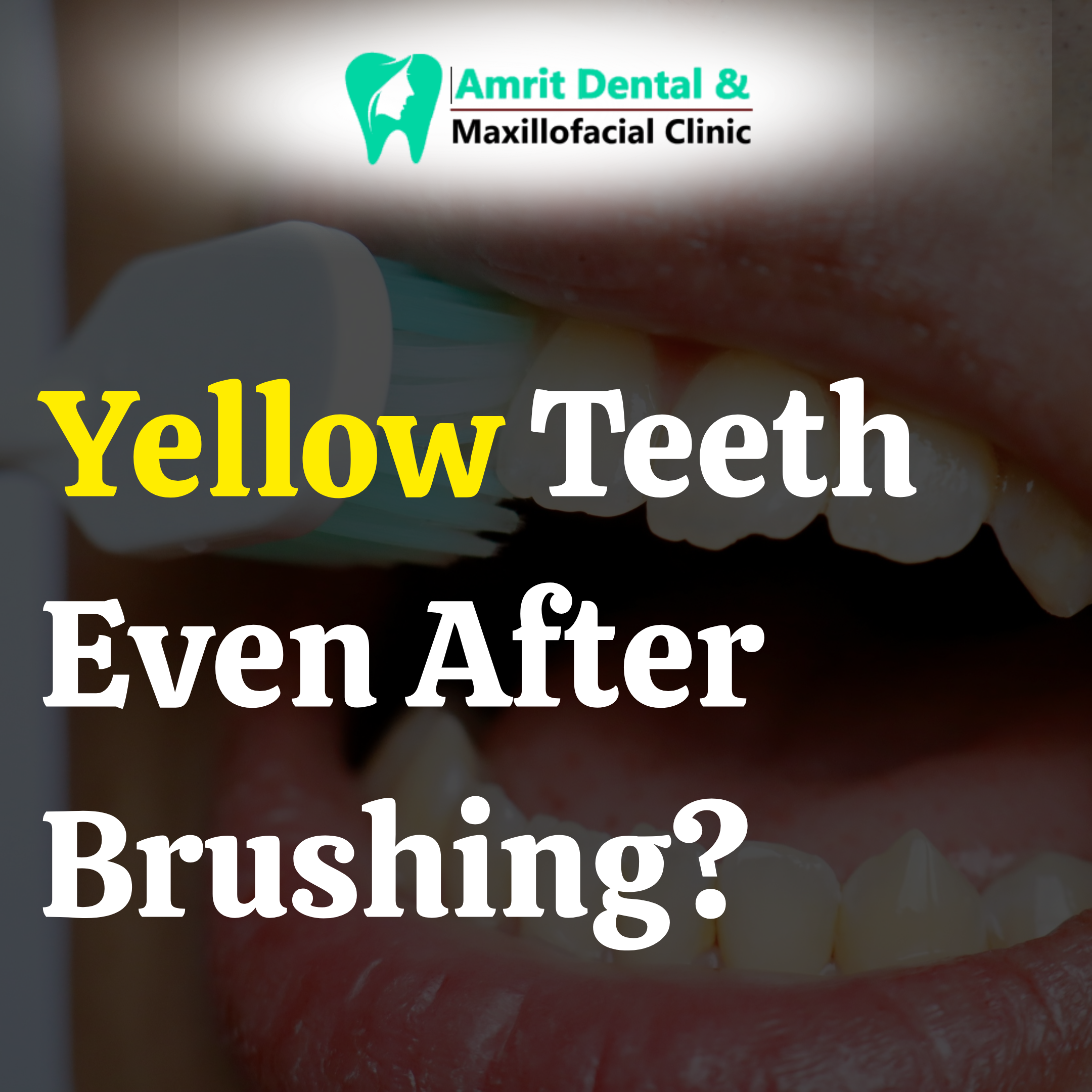 Yellow Teeth Even After Brushing?