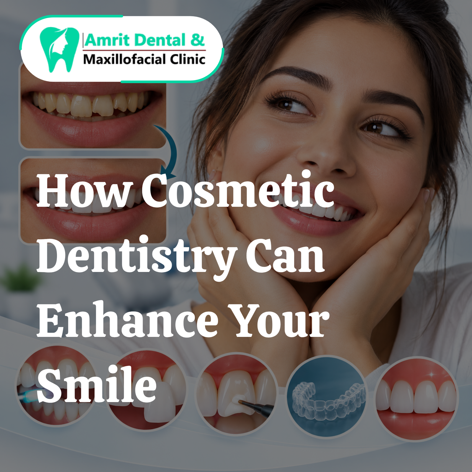 How Can Cosmetic Dentistry Transform Your Smile?